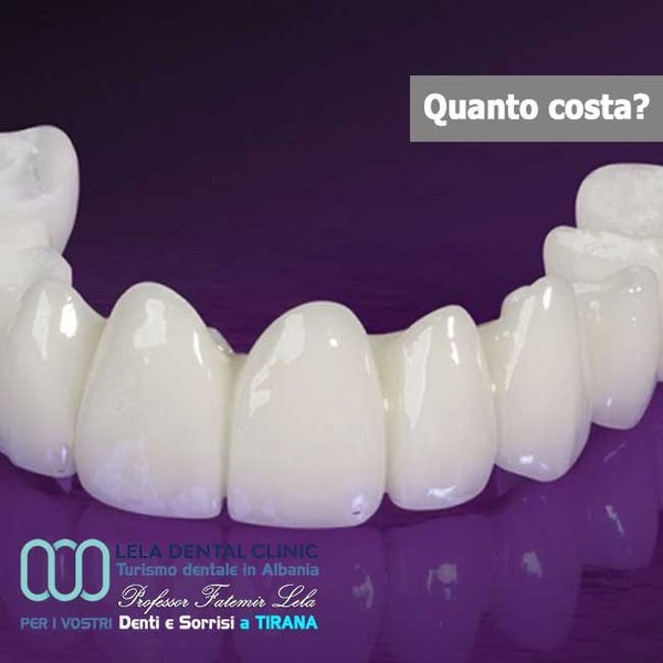 Arcata completa con corone in zirconio Lela Dental