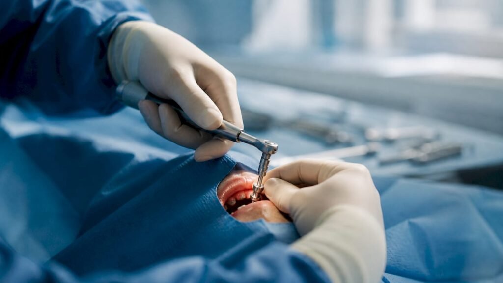 Le mani del medico applicano la coppia di serraggio all'impianto dentale