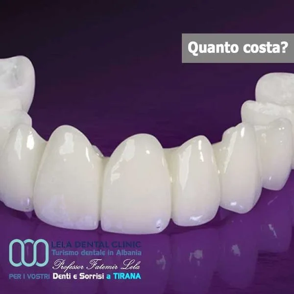 Arcata completa con corone in zirconio Lela Dental