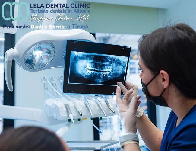 Team di professionisti Lela Dental Tirana