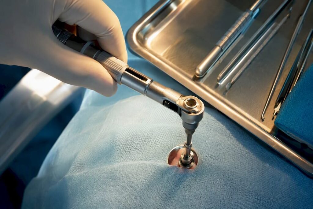 Misurazione della coppia su impianto dentale