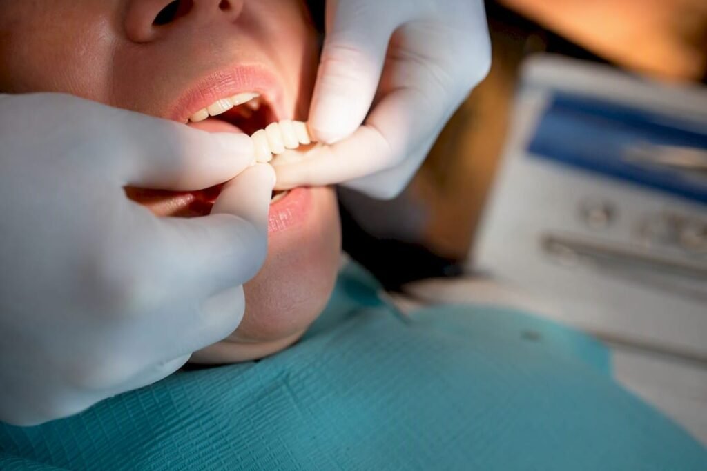 Protesi temporanea durante l'impianto dentale