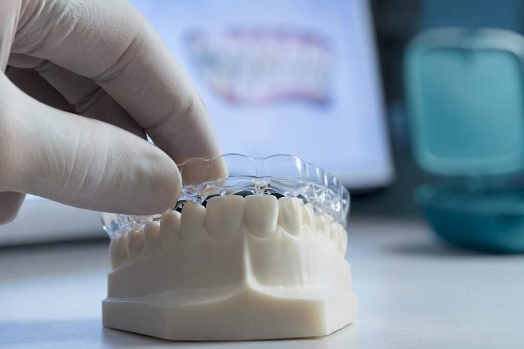 Allineatore trasparente su modello dentale