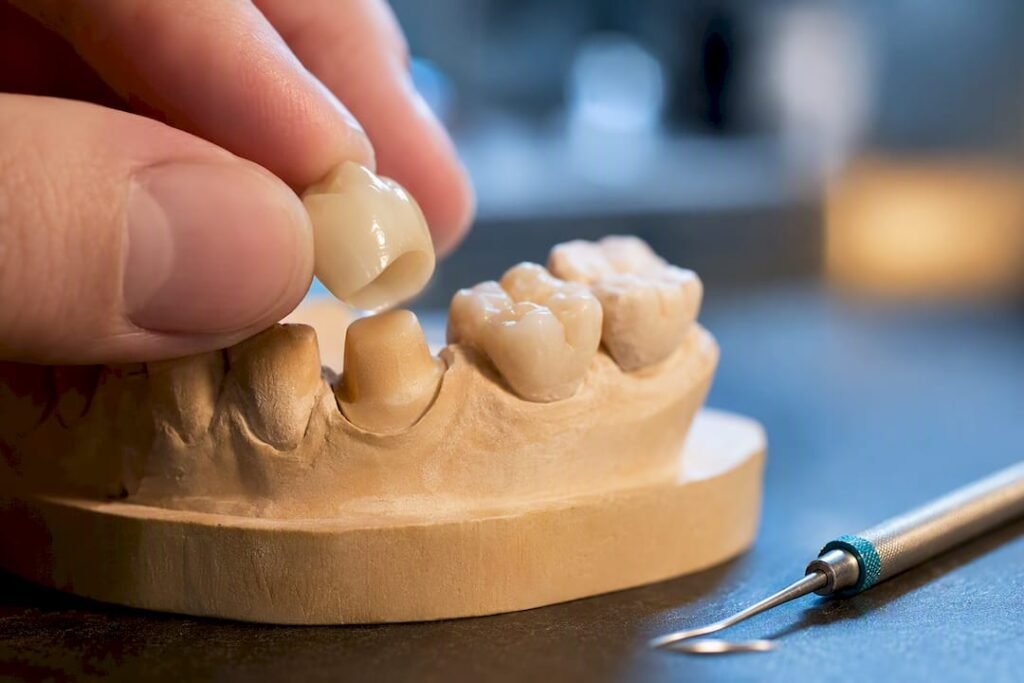 Dettaglio di una corona provvisoria su modello dentale